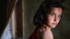 Suriye’de gözaltındaki çocuklara tecavüz