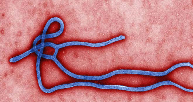 Ebola virüsü - Ebola virüsü nedir ? Ebola virüsü tedavi