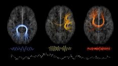 Yeni kimlik doğrulama yöntemi: Beyin dalgaları yeni parmak izimiz olabilir