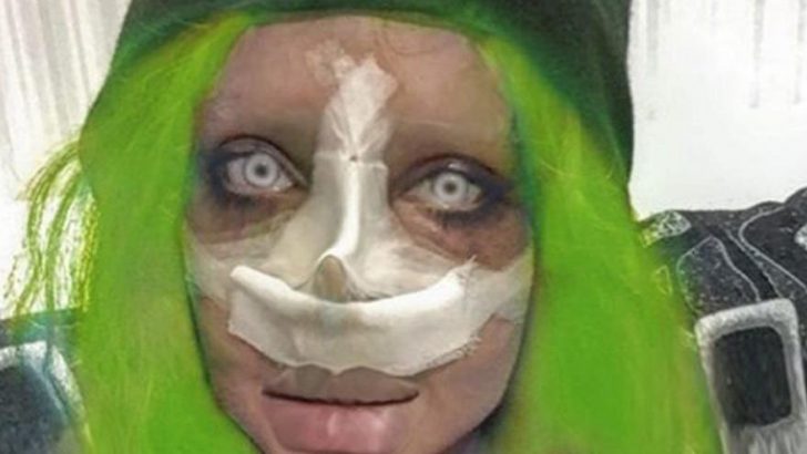 Angelina Jolie’ye benzemeye çalışan İranlı kadın 51’inci ameliyatını oldu